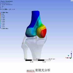 医学有限元分析丶头像